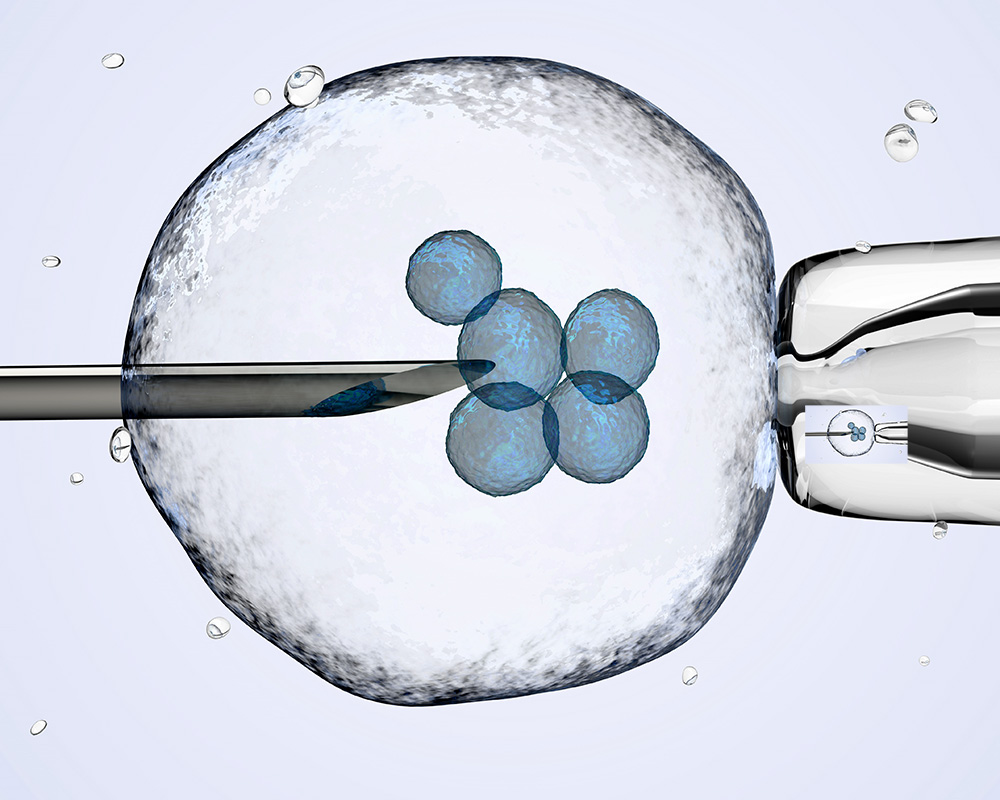 IVF egg extraction; Therapy for Infertility and Third-Party Reproduction Support