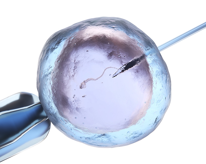 Sperm extraction for IVF and infertility treatment